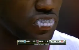 L’image du jour : le protège-dents de LeBron James