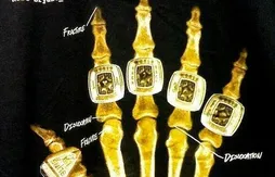 L’image du jour : une radiographie de la main de Kobe Bryant