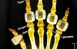 L’image du jour : une radiographie de la main de Kobe Bryant