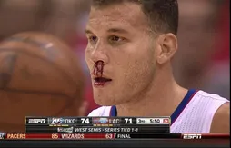[replay] Blake Griffin le nez en sang