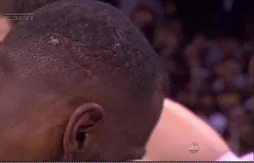 Les images de la blessure à la tête de LeBron James