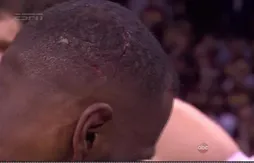 Les images de la blessure à la tête de LeBron James