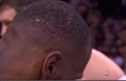Les images de la blessure à la tête de LeBron James