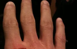 Le Shaq a-t-il mordu Stephen Curry ?