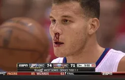 [replay] Blake Griffin le nez en sang