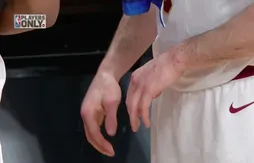 Kevin Love : pas d’opération mais deux mois d’absence
