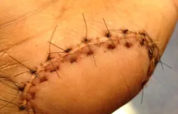 Trash : la main d’Amare Stoudemire