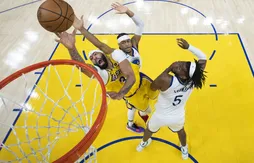 Anthony Davis touché au visage