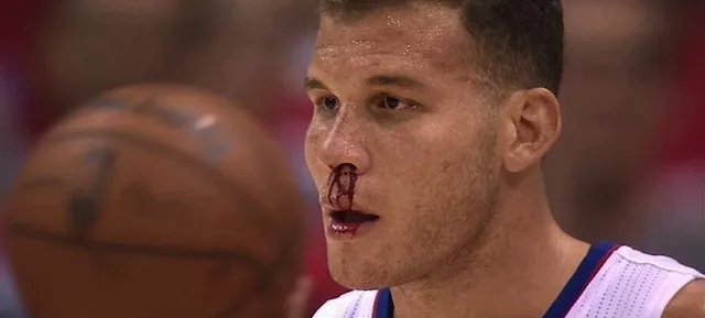 blake griffin