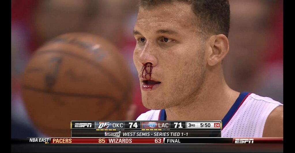 Blake Griffin